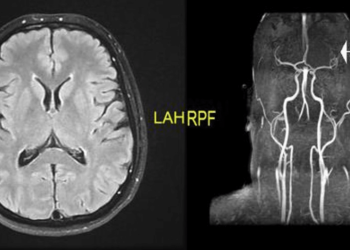 The Path of Aspiring Fighters in Amateur MMA Showdowns